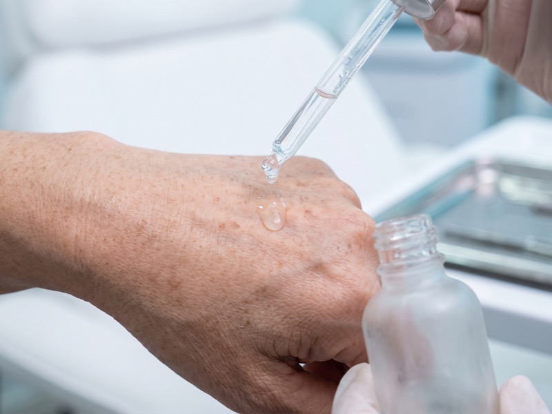 A glass dropper releasing a drop of clear serum onto the back of a mature hand in a clinic room